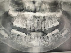 -宁波儿童口腔医院(钱湖院区)
