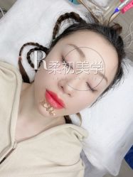 -RC半永久纹眉纹发际线