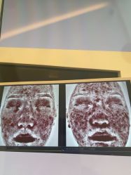 -苑苑vbeauty科技美容SPA