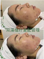 -凡碧诗毛孔收细