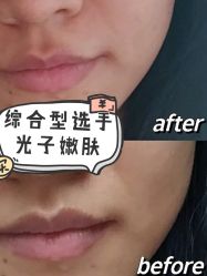 -广州美莱医疗美容医院