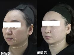 -Yestar重庆艺星医疗美容医院