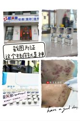 -靓芙泉专研痘痘肌