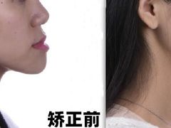 -团圆口腔·种植中心(锦江院区)