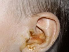 -AudioNova 海之声助听器峰力助听器索诺瓦自营店(北京店)