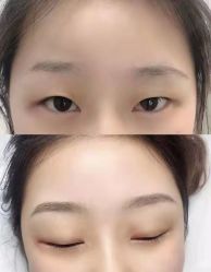 -莲姿娜半永久纹眉皮肤管理