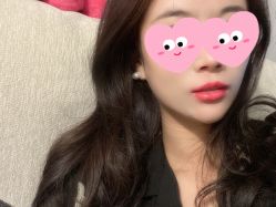 体验后-More摩尔医美の注射线雕光电中心