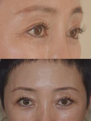 -清疣美疣·痣·斑净肤中心