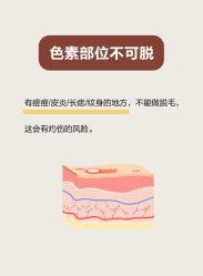-MUSES专业脱毛比基尼サロン日式连锁