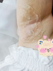 -植蔻妍倍儿专业脱毛·皮肤管理