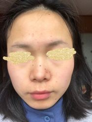 -皇族养心堂·净痘·修敏·御颜
