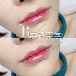 -RC半永久纹眉纹发际线