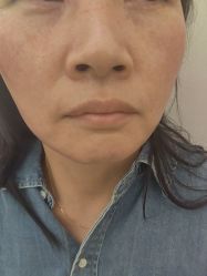 -长沙雅美医疗美容医院