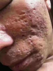 -禾壹净·素颜美问题肌肤修护中心