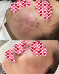 -康美贞·痘肌养护管理中心