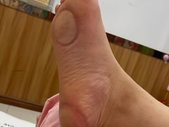 -郑远元专业修脚房(岭兜二路店)