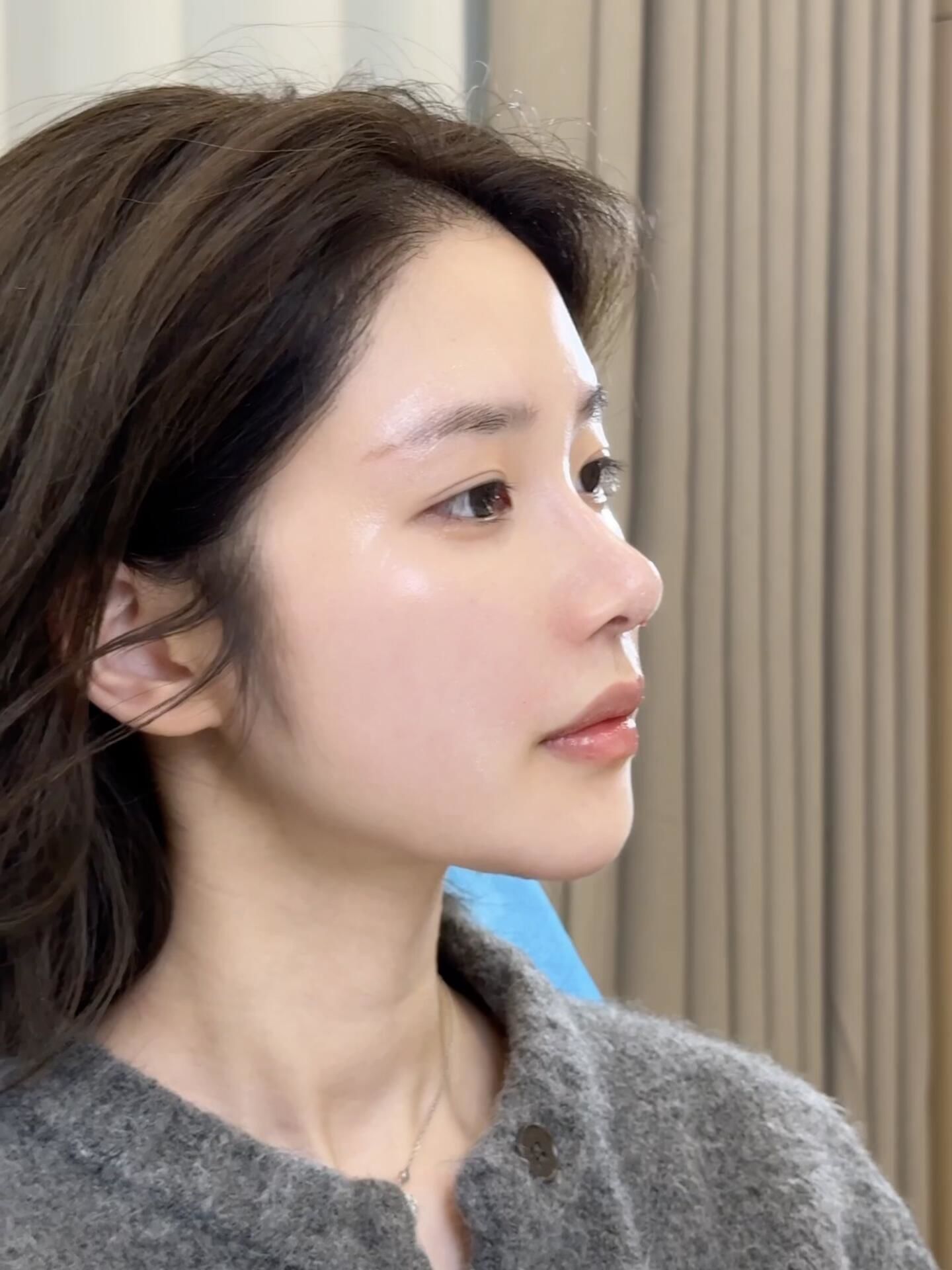 0.7ml低山根微起伏小翘鼻