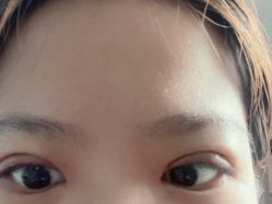 体验后-西安伊美尔医疗美容医院