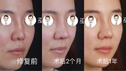 -北京米扬丽格医疗美容·联合丽格鼻整形中心