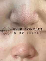 点击看大图 -MLP美丽派·问题肌疗愈中心