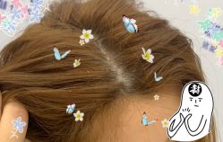 -大麦微针植发全国连锁