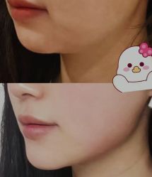 -铂特丽医美·眼鼻整形·光电美肤·注射抗衰
