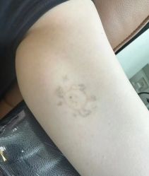 -天道专业洗纹身