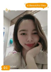 -大麦微针植发全国连锁