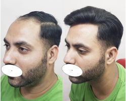 -发饰美男士增发补发假发定制店