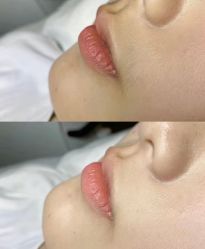 -春田皮肤管理中心品牌旗舰店
