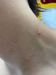 -百年美肤堂祛痦痣祛斑祛疣