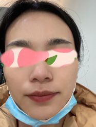 体验后-北京炫美医疗美容