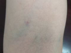 -中国人民解放军总医院