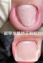 -杨红水晶延长美甲美睫