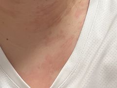 -苏州大学附属第二医院(三香院区)