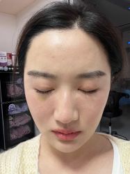 点击看大图 体验后-深圳美莱医疗美容医院