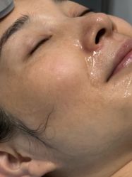 -长沙雅美医疗美容医院
