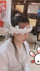 点击看大图 -大麦微针植发丨全国连锁