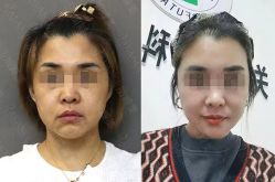 -加减美医美连锁品牌