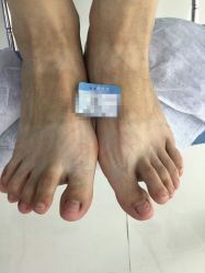 点击看大图 -派恩宜灰指甲鸡眼嵌甲手足癣