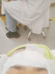 -苗医生0感科技祛痘