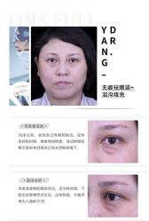 -丰联丽格医疗美容·联合丽格眼整形中心