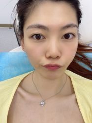 体验前-Dr.U博士医疗美容医院