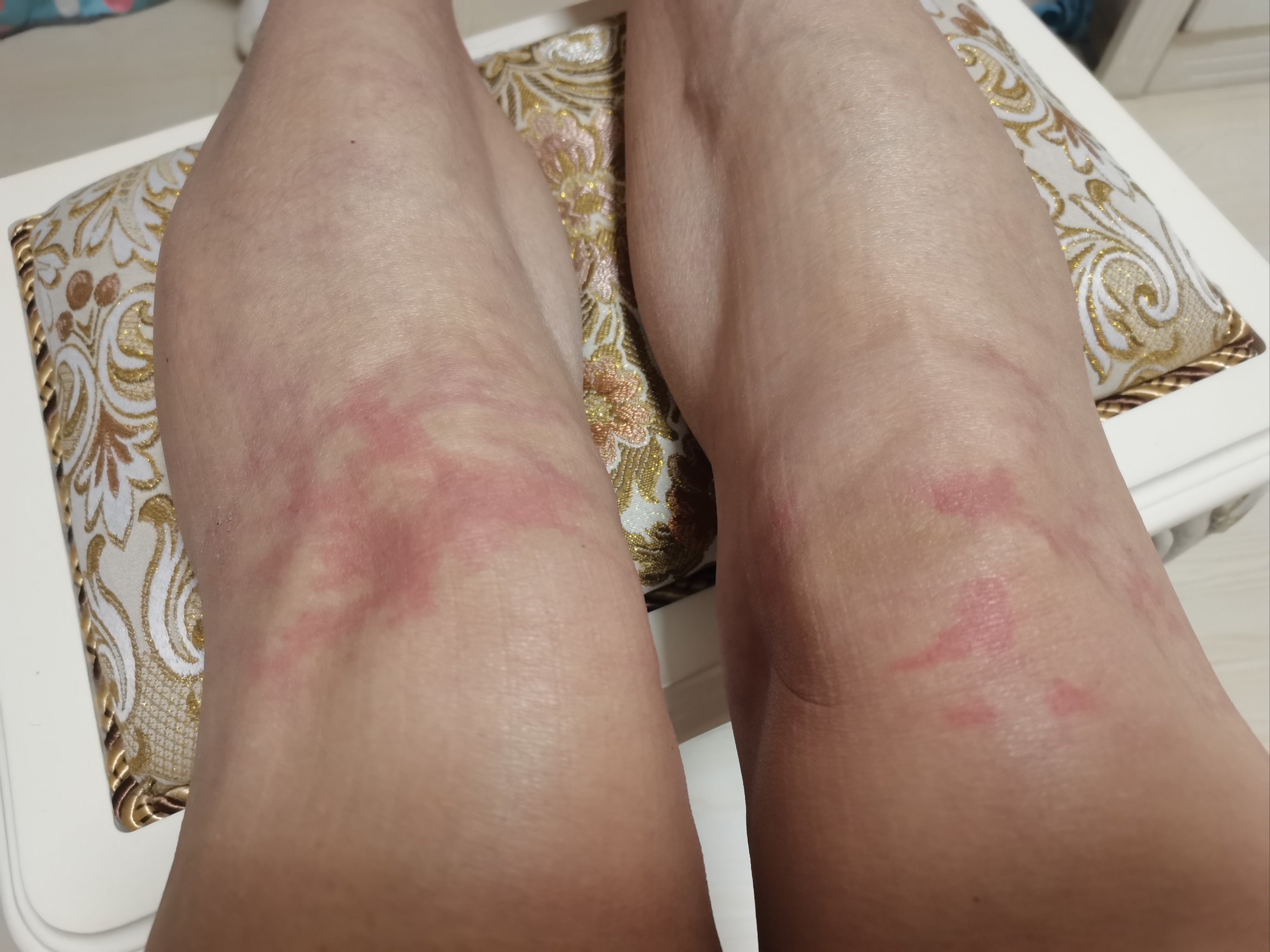 我的老寒腿有救了