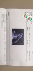 -艾博尔医院