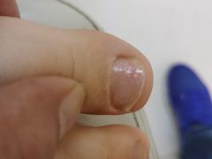 -新甲连锁灰指甲·甲沟炎·鸡眼(黑龙江路店)