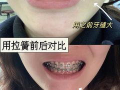 -极光口腔·矫正种植修复(锦江店)