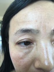 -西施无菌半永久纹绣眉眼影唇轻增发纹发际线