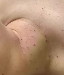 -+MS卓美丝专业祛痘·皮肤管理中心