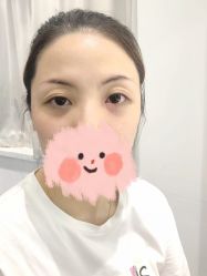 -MIVI半永久纹眉绣眉